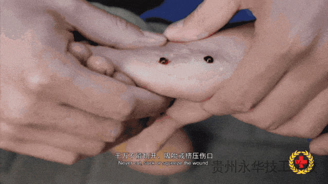 已进入活跃期！防蛇安全指南，请转发给身边的朋友！