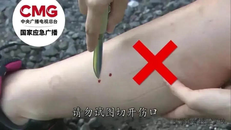 已进入活跃期！防蛇安全指南，请转发给身边的朋友！