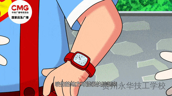 已进入活跃期！防蛇安全指南，请转发给身边的朋友！